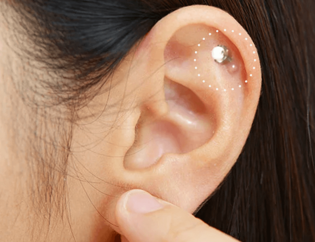 Signs of Bump Piercing You Shouldn’t Ignore & How to Fix It — image 1
